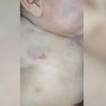 Bebé internado tras presunta agresión en Minga Guazú