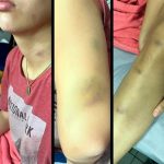 Modelo denuncia violencia de parte de funcionario judicial