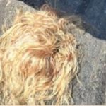 Accidente en Lambaré dejó a pasajera sin cuero cabelludo